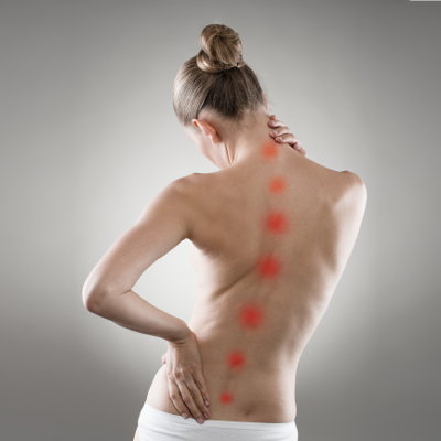 Scoliosis in Cookstown, Ontario