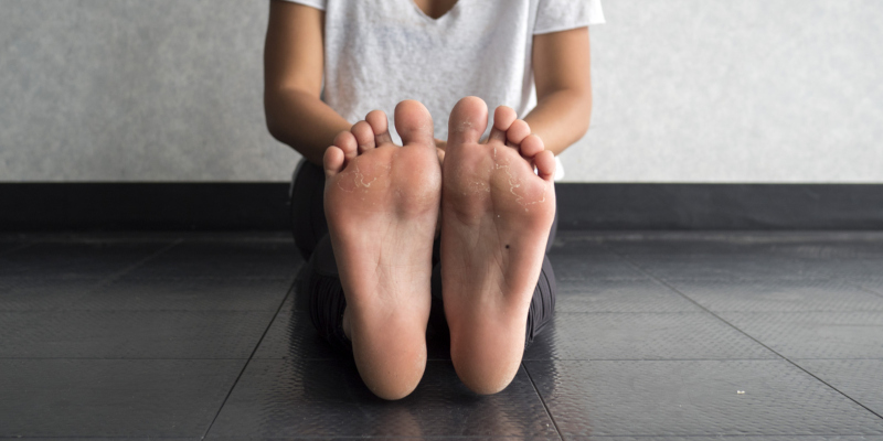 Custom orthotics help correct the position of your feet