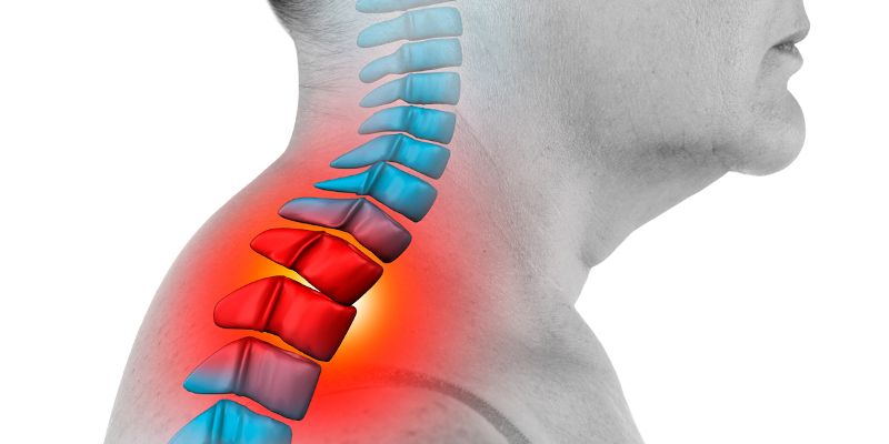 Symptoms of Pinched Nerves